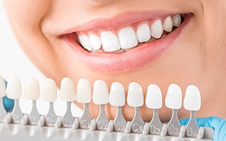 Smile compared with tooth color chart