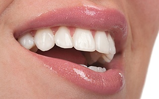 Closeup of flawless teeth and gums