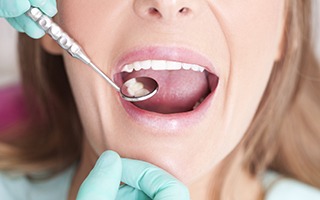 Closeup of smile during dental exam