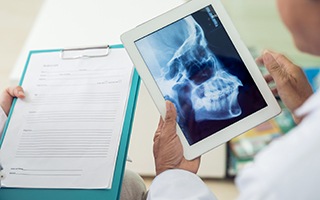 X-ray of jaw and skull